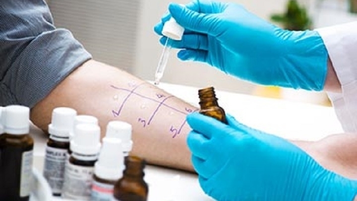 Allergy Testing and Treatment